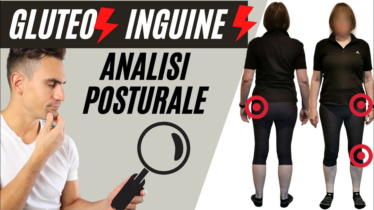 💢 sciatalgia, dolore alla natica, dolore ginocchio esterno, dolore inguine | Valutazione posturale
