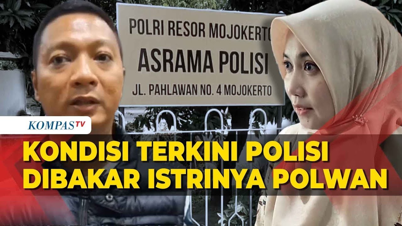 Begini Kondisi Polisi Jombang yang Dibakar Istrinya Polwan di Mojokerto
