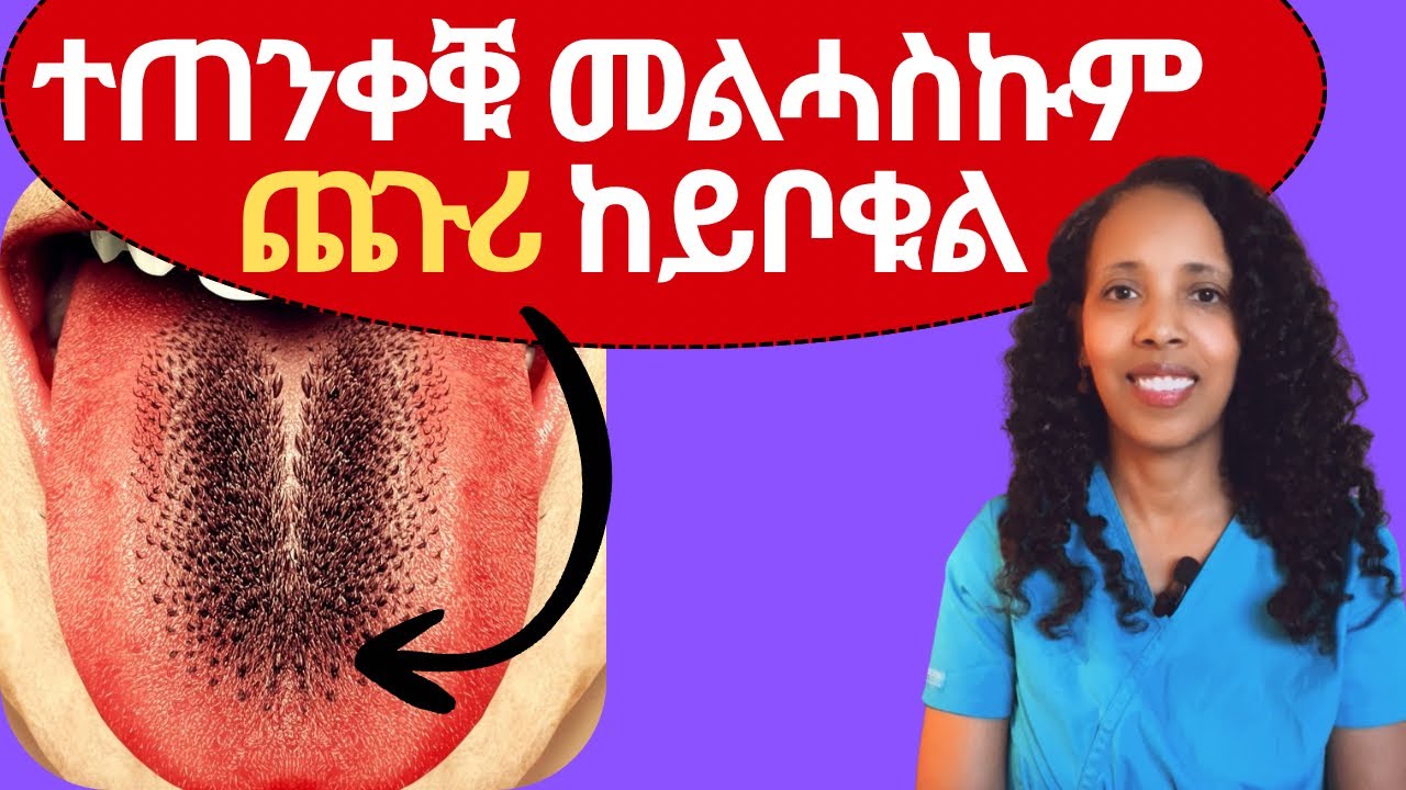 ተጠንቀቑ መልሓስኩም ጨጉሪ ከይቦቁል #habesha #eritrean #Tigriny #ጥዕና  #health  #dentalcare 