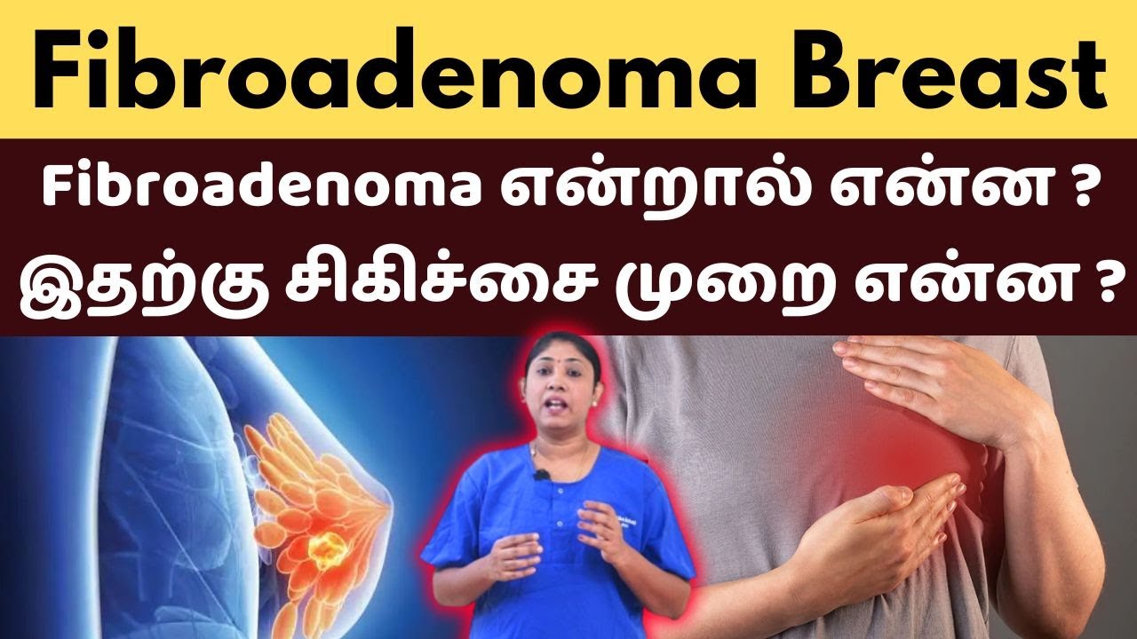 Fibroadenoma Breast | Fibroadenoma என்றால் என்ன ?  இதற்கு சிகிச்சை முறை என்ன ?