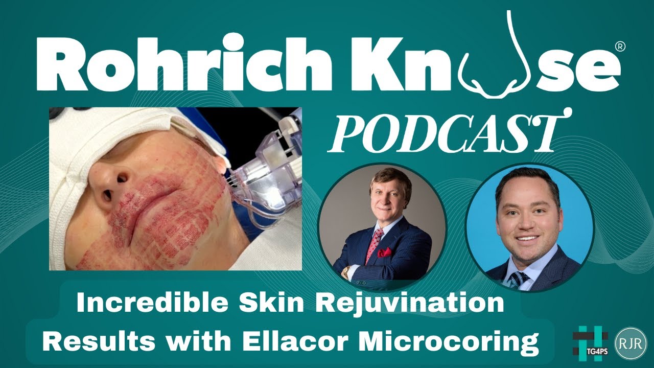 Incredible Skin Rejuvenation Results with Ellacor Microcoring