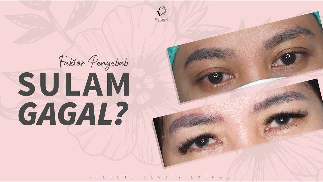 FAKTOR PENYEBAB SULAM GAGAL