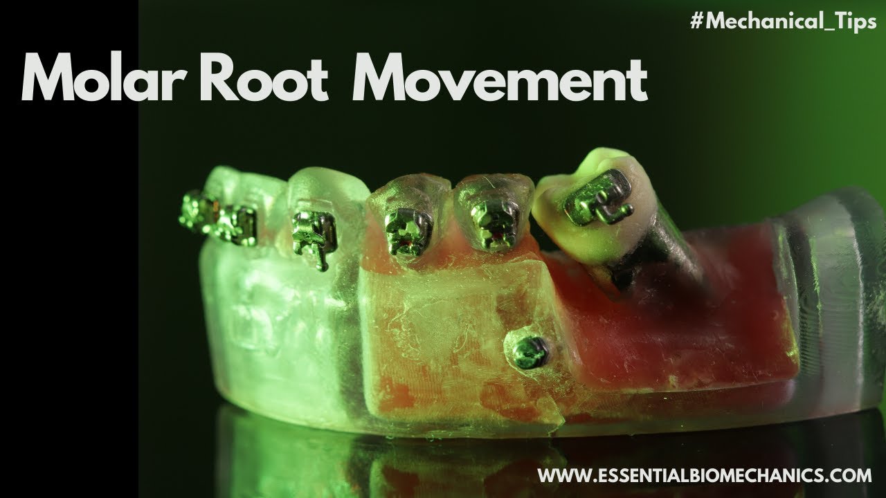 Molar_Root_Movement | Essential Biomechanics