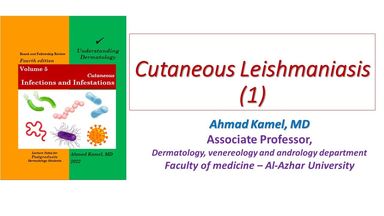 Cutaneous Leishmaniasis 1