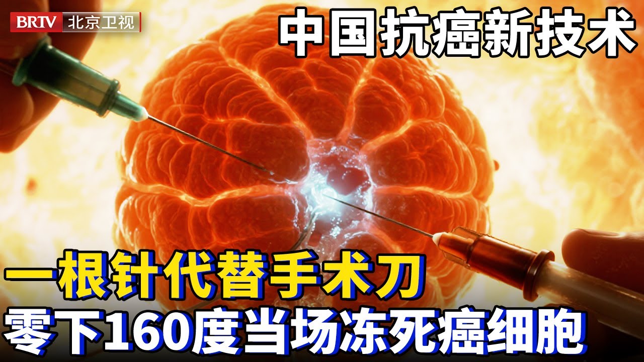 中国抗癌新技术，一根针代替手术刀，零下160度低温杀癌，当场冻死肿瘤【为你喝彩】