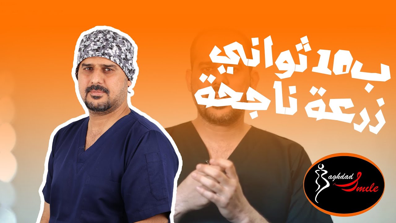 شون تزرع اسنان خلال 10 ثواني.. شوف طريقتنا بزراعة الاسنان .. ابتسامة بغداد لطب الاسنان