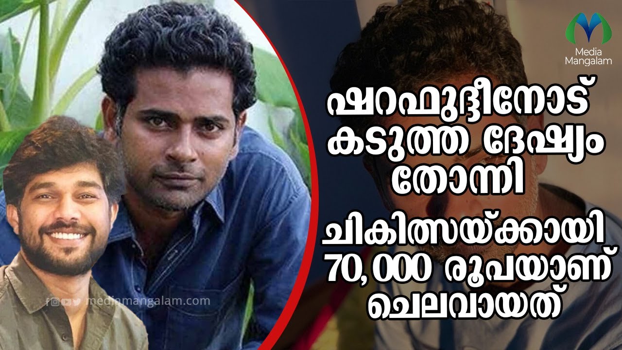 ഭക്ഷ്യവിഷബാധയേറ്റ അനുഭവം പറഞ്ഞ് അൽഫോൺസ് പുത്രൻ | Sharaf U Dheen  | Alphonse Puthren