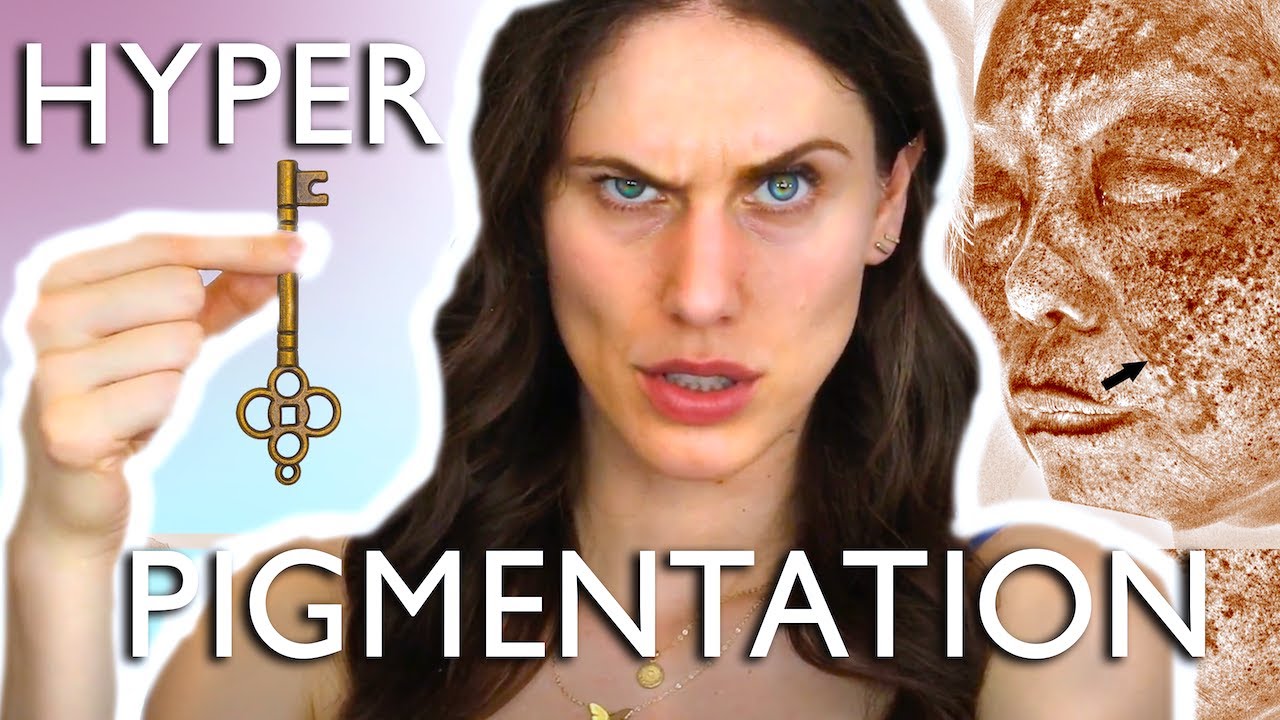 The Keys To Hyperpigmentation? Skincare Routine That Actually Works | Morning & Nighttime