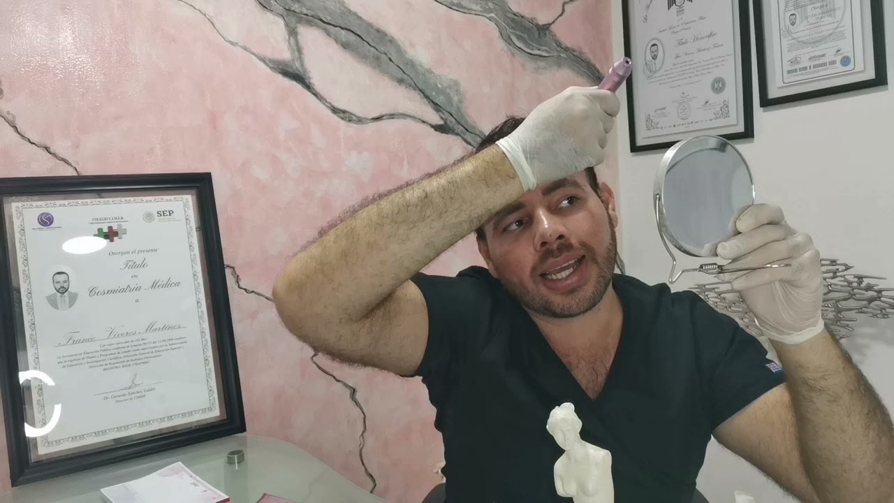 Como usar el dermapen, paso a paso, técnica para profesionales.
