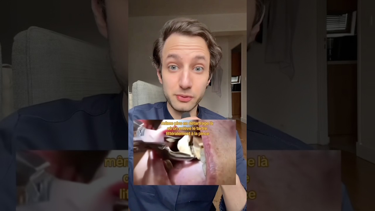 DU JAMAIS VU SUR UNE DENT 🦷 #dentiste #dent #parodontite #tartre