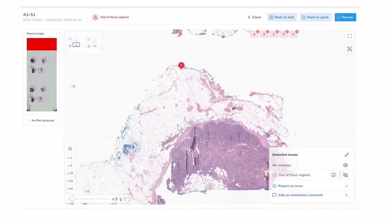 AI-powered quality assurance in digital pathology with SlideRightQA