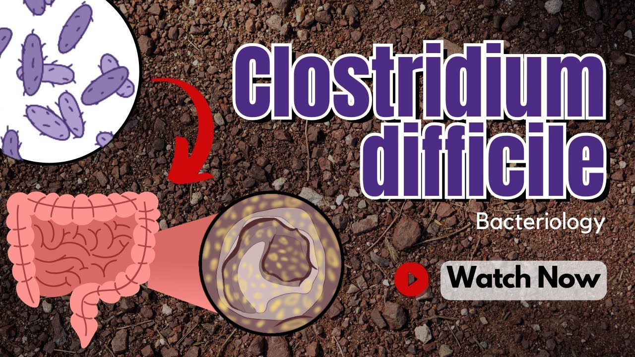 Clostridium Difficile Explained: Symptoms, Diagnosis, and Management | Bacteriology