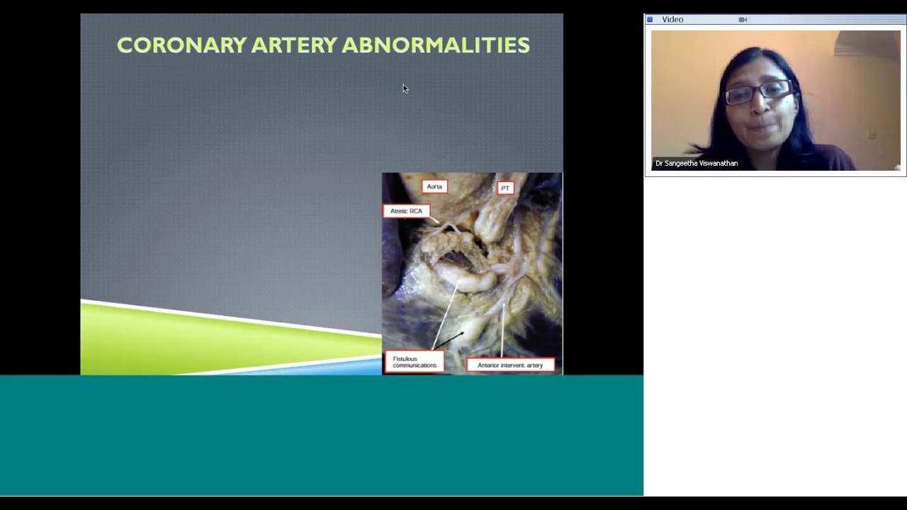 Pulmonary atresia intact septum evaluation Part1 by Dr Sangeetha