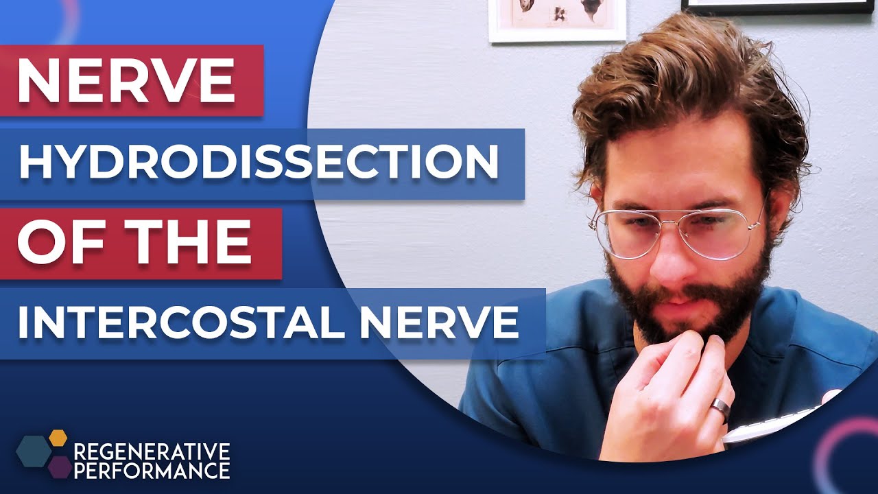 Nerve Hydrodissection of the Intercostal Nerve