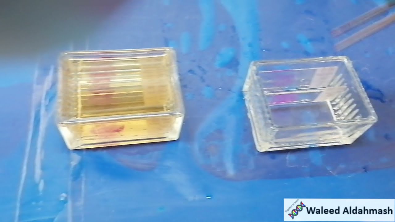 طريقة الكشف عن الكربوهيدرات في القطاعات النسيجية Periodic Acid-Schiff (PAS) staining