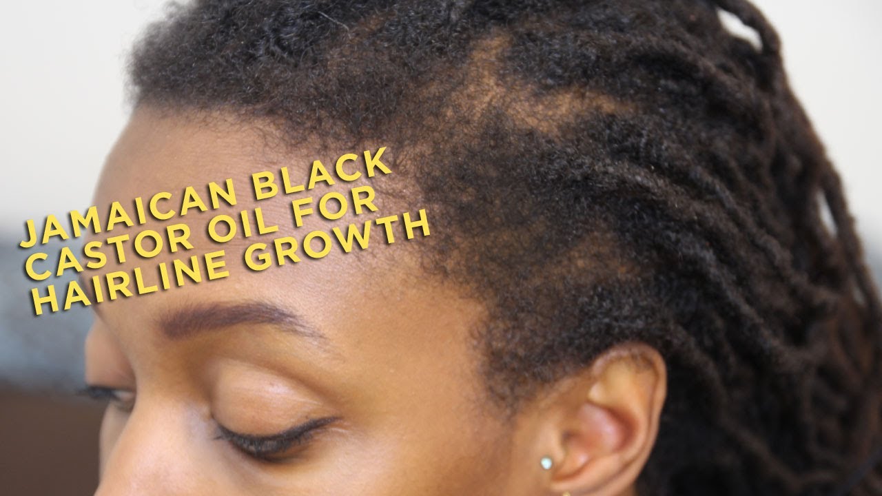Product Review: Jamaican Black Castor Oil for Hairline Growth