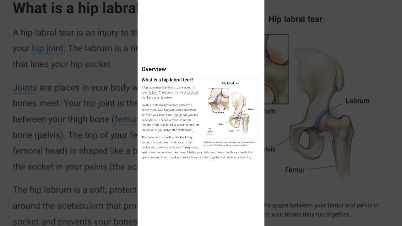 What is a Labral Tear? 