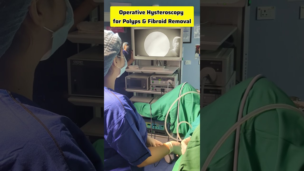 Operative Hysteroscopy for Polyps and Fibroids Removal, Hysteroscopic Polypectomy #drrakshitamalik