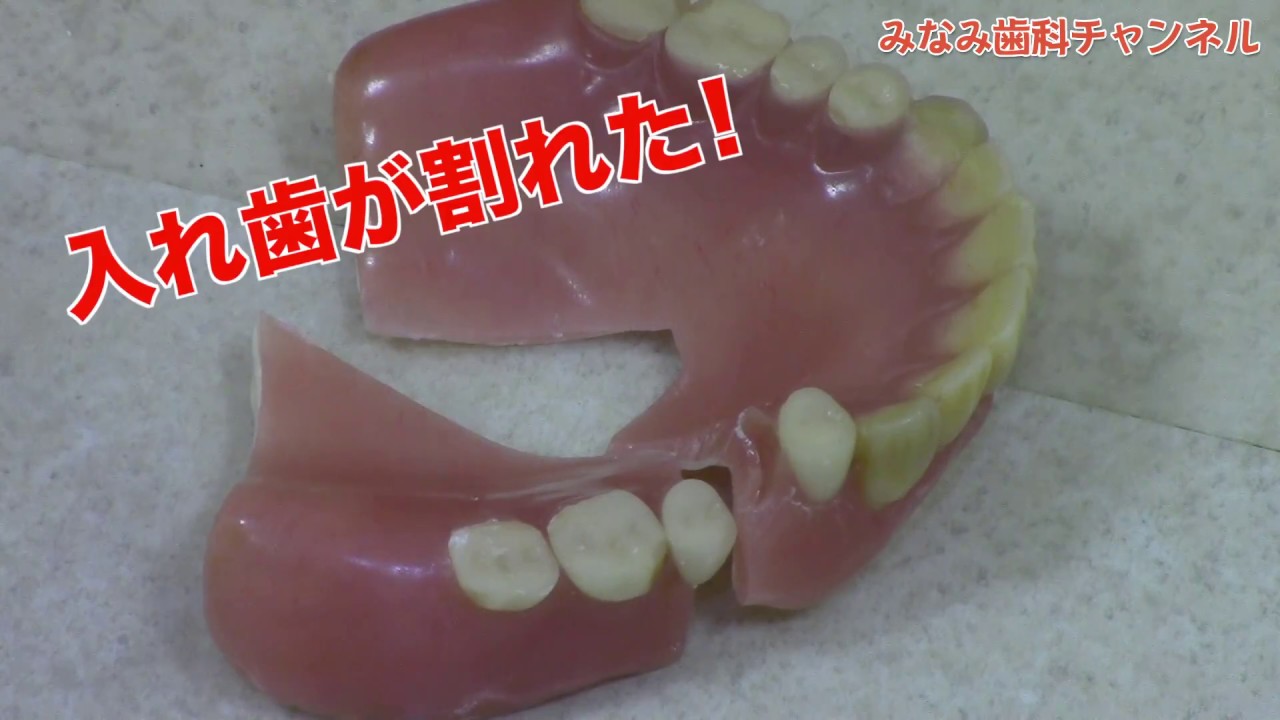 【能代市 訪問歯科】入れ歯がわれました。修理できますか？_みなみ歯科チャンネル029（口腔ケアチャンネル）