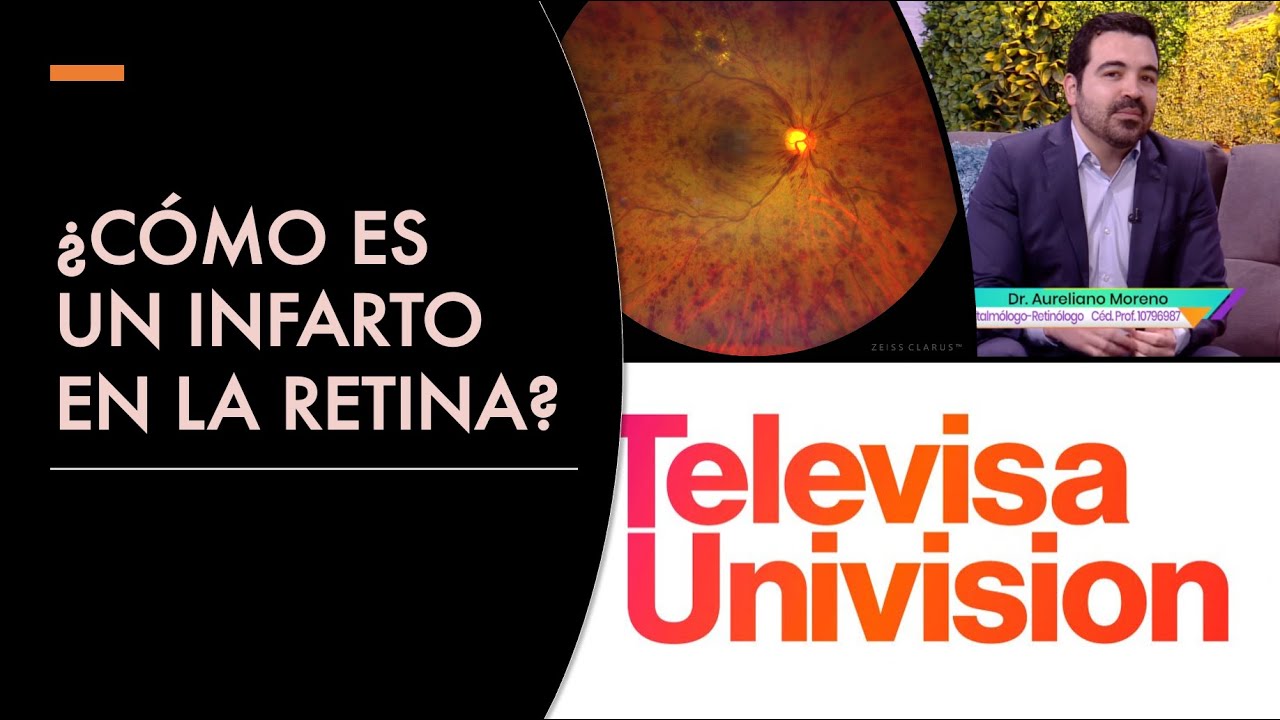 🆘👁Infartos en los Ojos | Oclusión de Vena y Arteria Central de la Retina | Dr. Aureliano Moreno