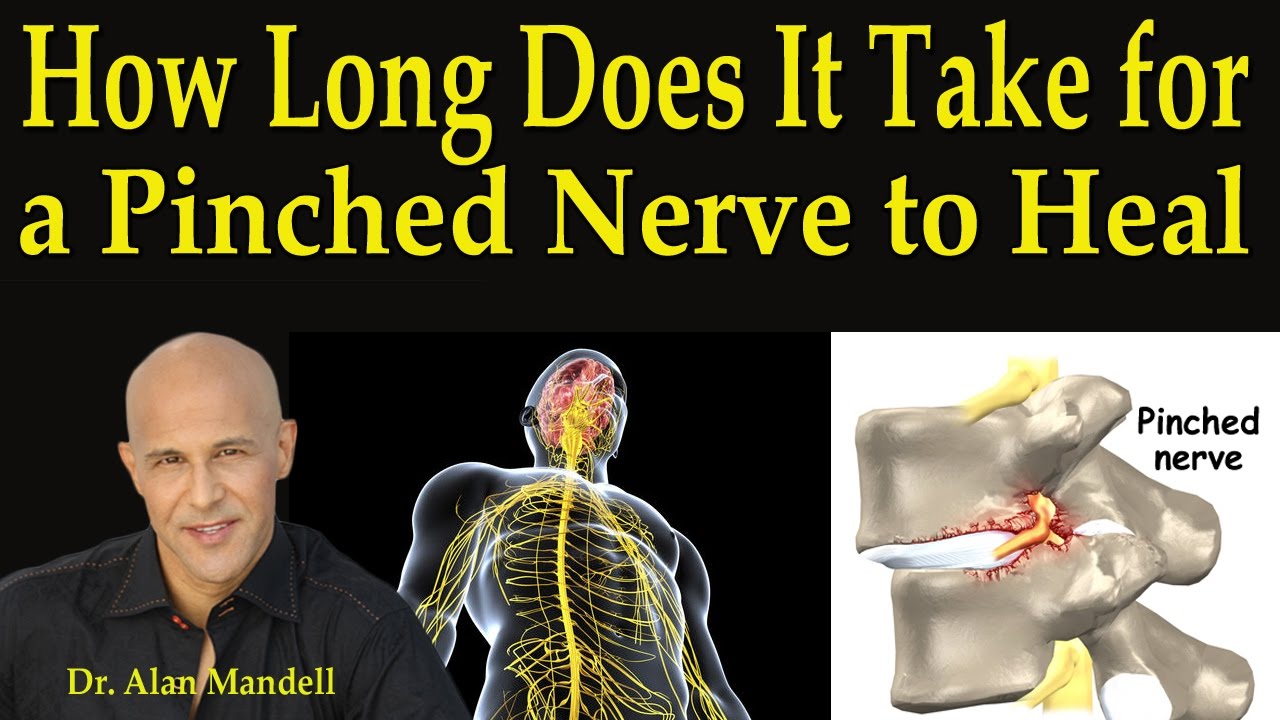 How Long Does It Take For A Pinched Nerve to Heal - Dr Mandell