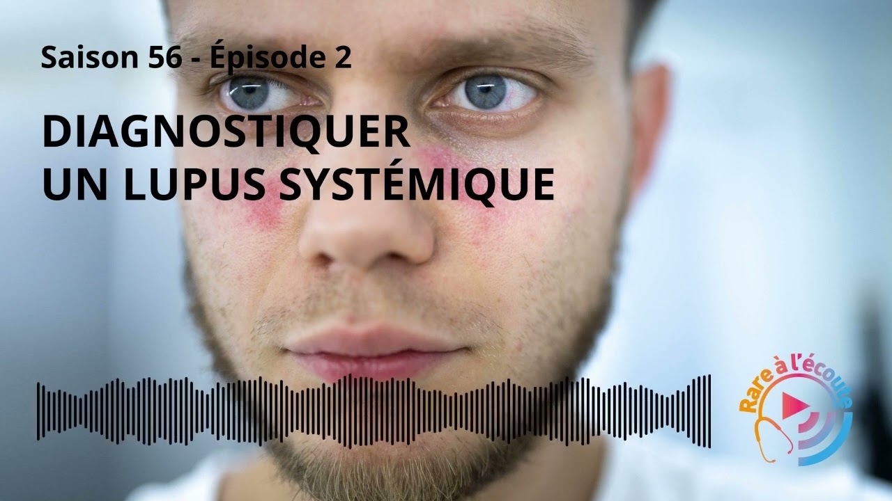 Maladie rare - Diagnostiquer un lupus syst&eacute;mique