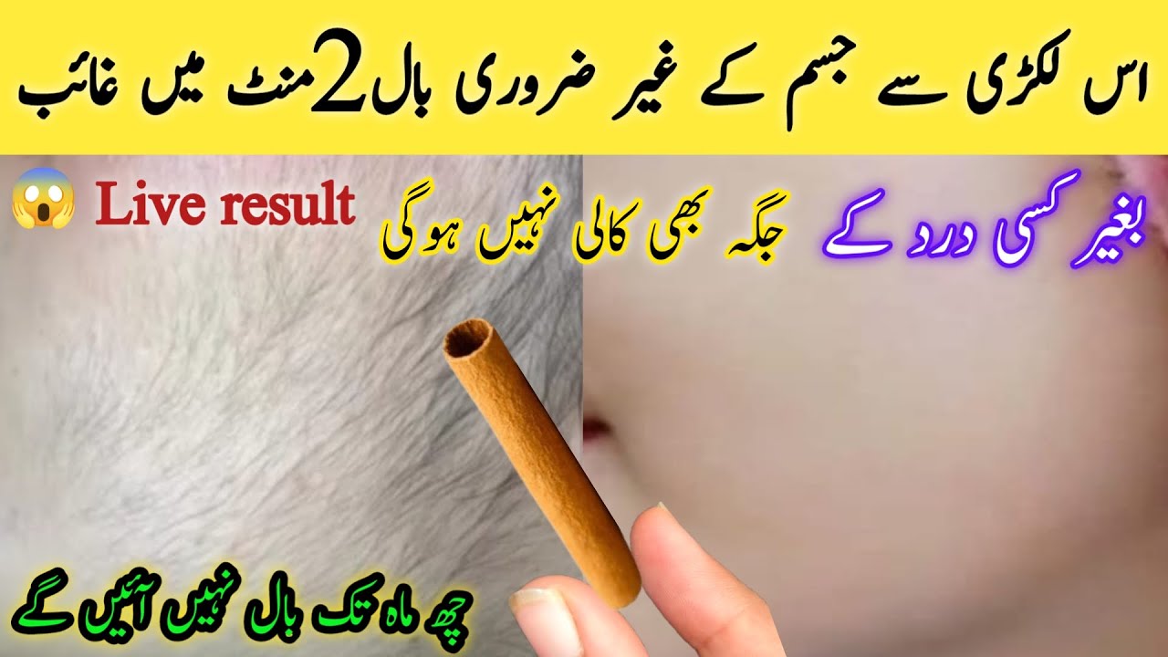No threading 👉😱I wonder how aunty's beard & mustache were removed | Facial hair removal at home