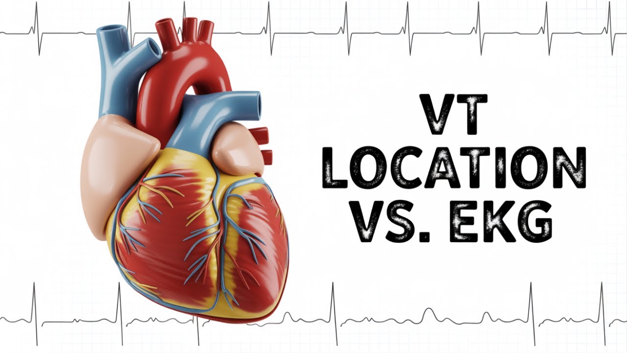 Ventricular tachycardia localisation by 