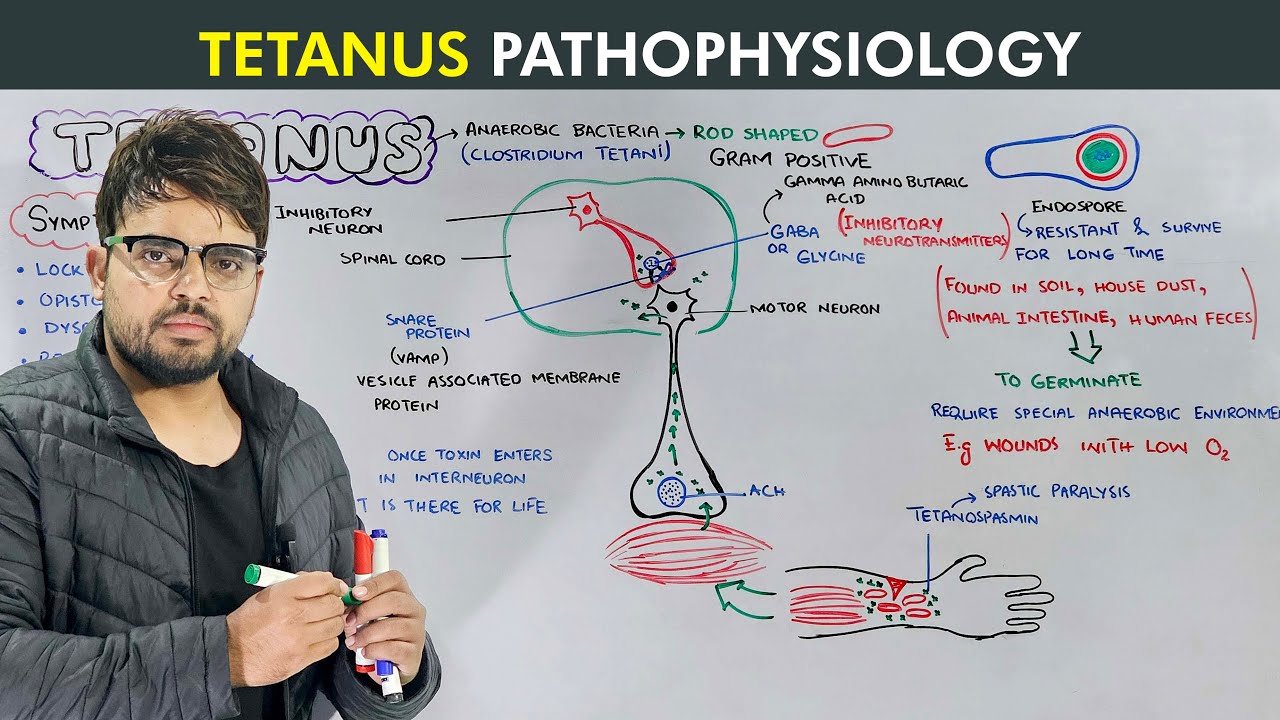 Tetanus: Causes, Symptoms, Prevention and Treatment Biology lecture