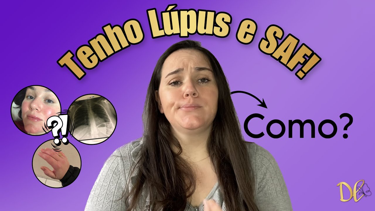Como descobri o Lúpus e a SAF!