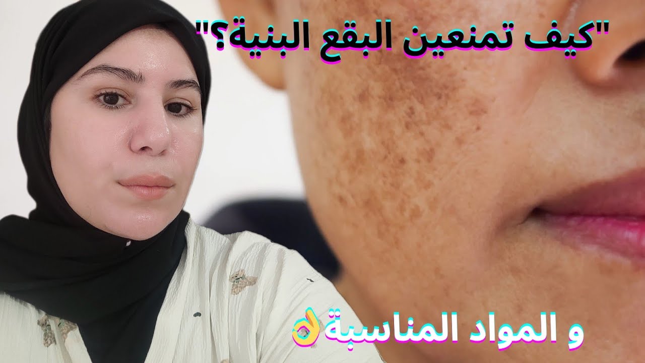 البقع البنية: السبب الحقيقي والحل النهائي!