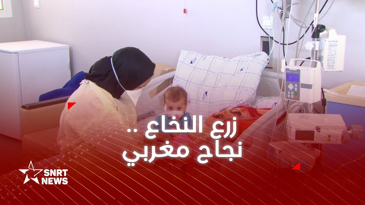 تميز طبي .. زرع نخاع عظمي