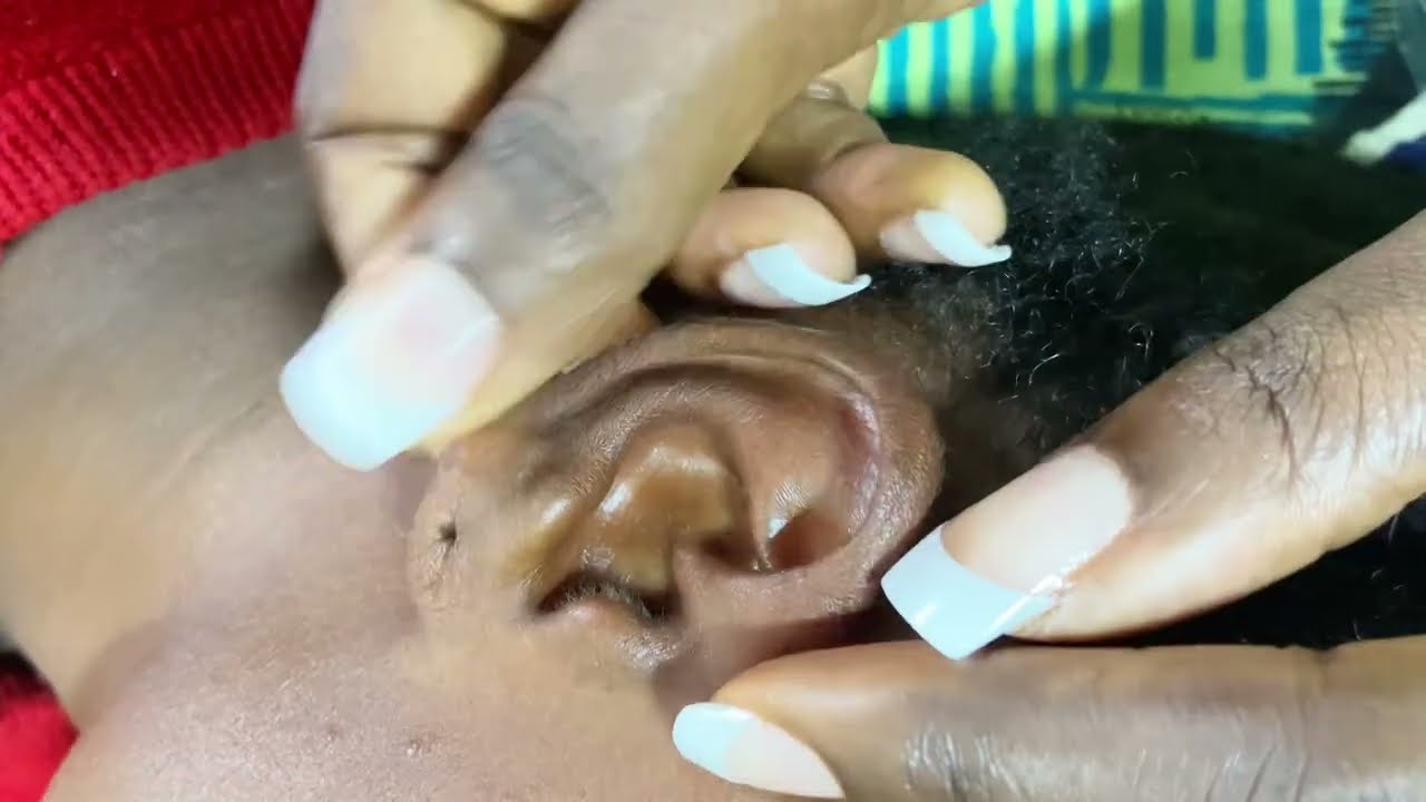 ASMR ✨ A REAL PERSON EAR CLEANING & PICKING - SOFT TOUCHING