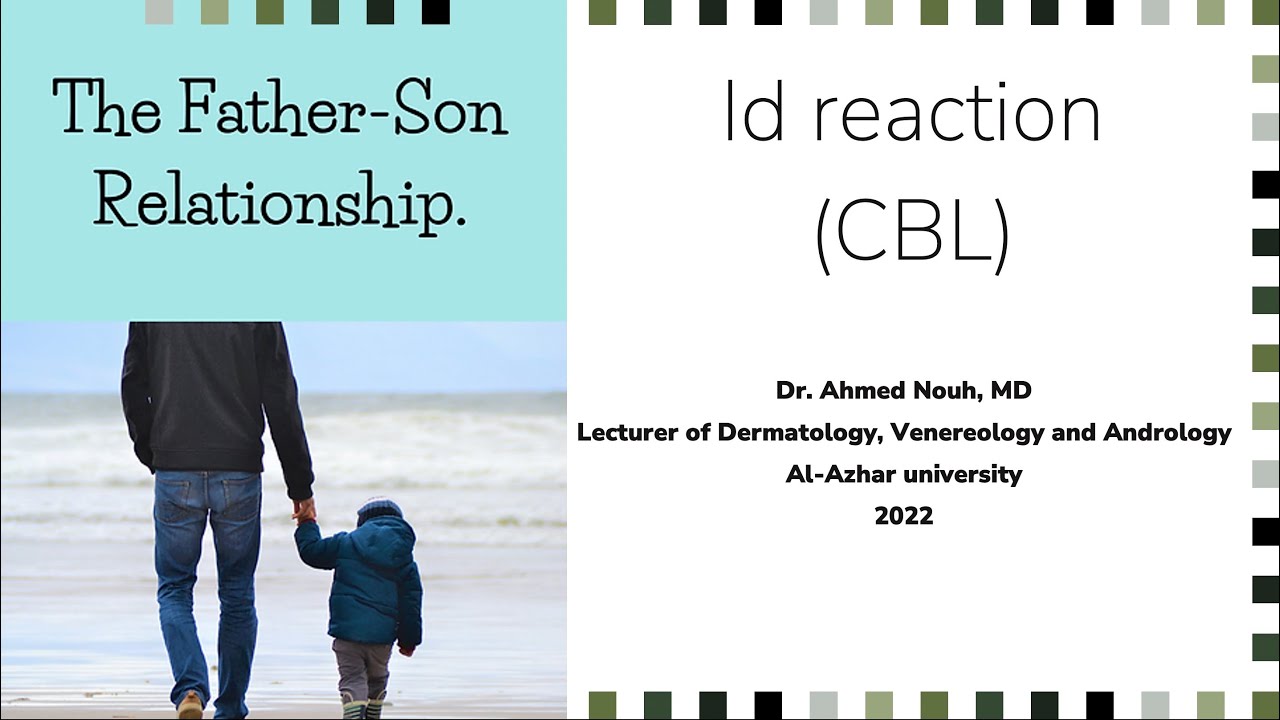 Id reaction