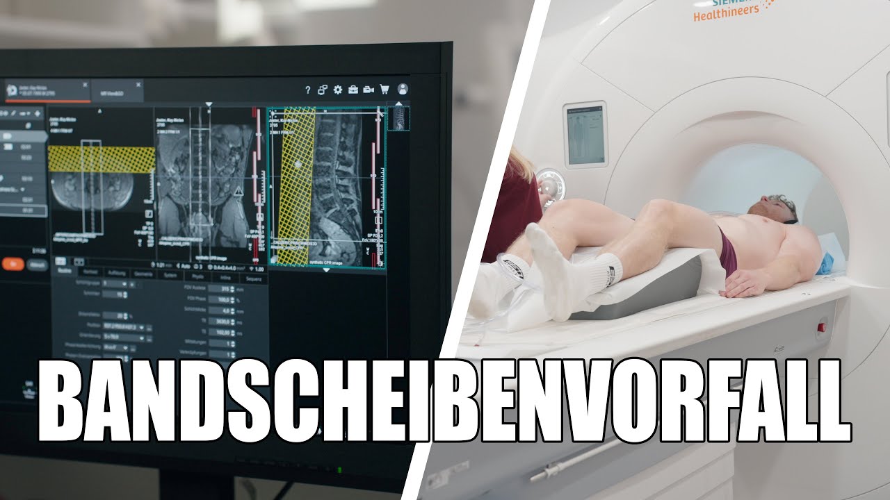 Diagnose: Bandscheibenvorfall (die bittere Wahrheit)