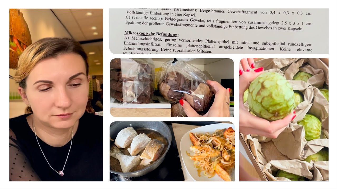 Рак Нёбной Миндалины Плоскоклеточная Карцинома 🏥 Варианты Лечения 💉 Влог 2.11.2022