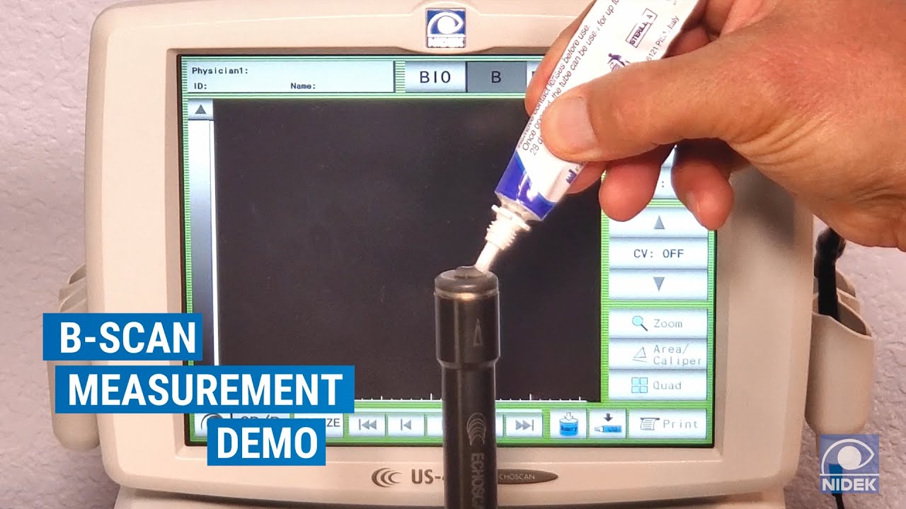 NIDEK US-4000/500 Ultrasound | B-scan Overview