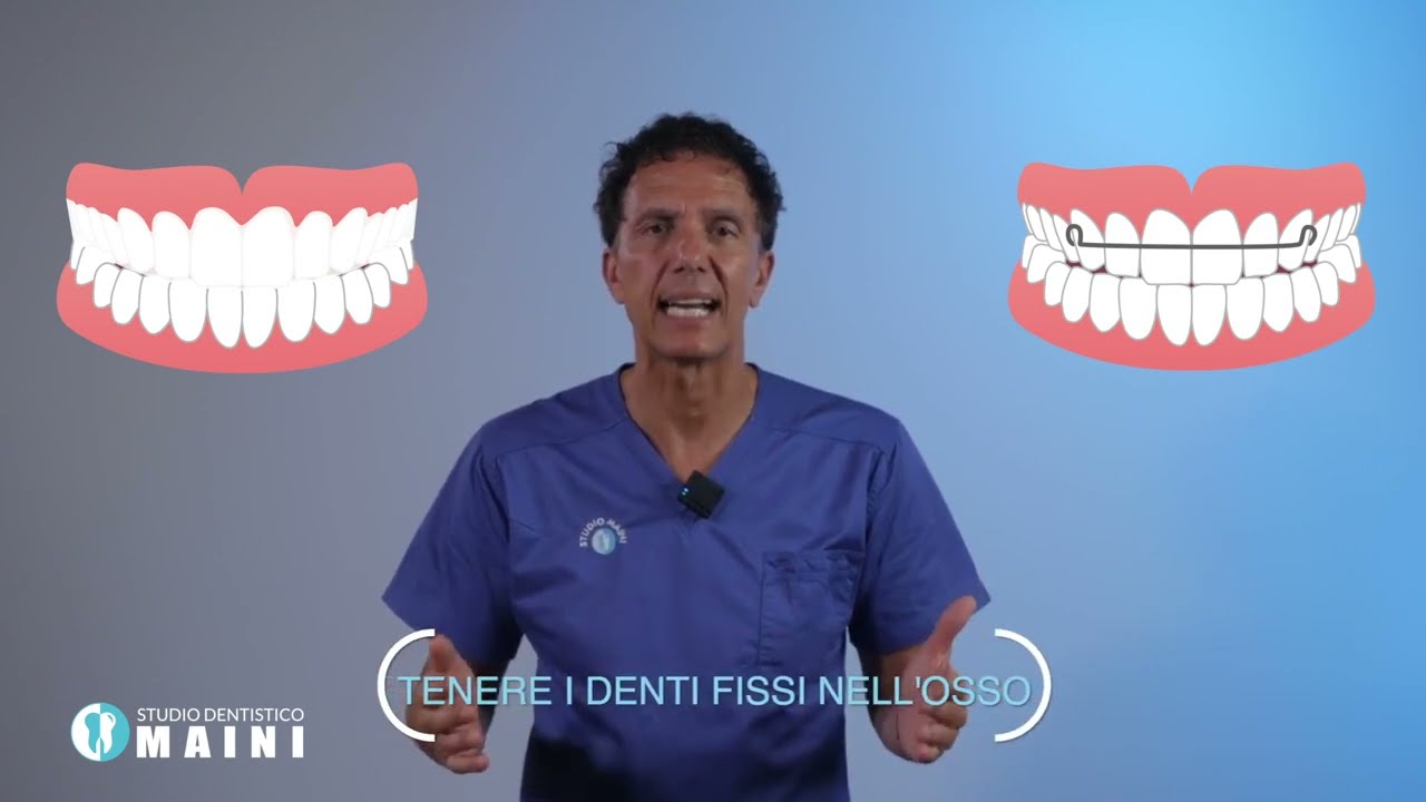 La contenzione: denti dritti per sempre!