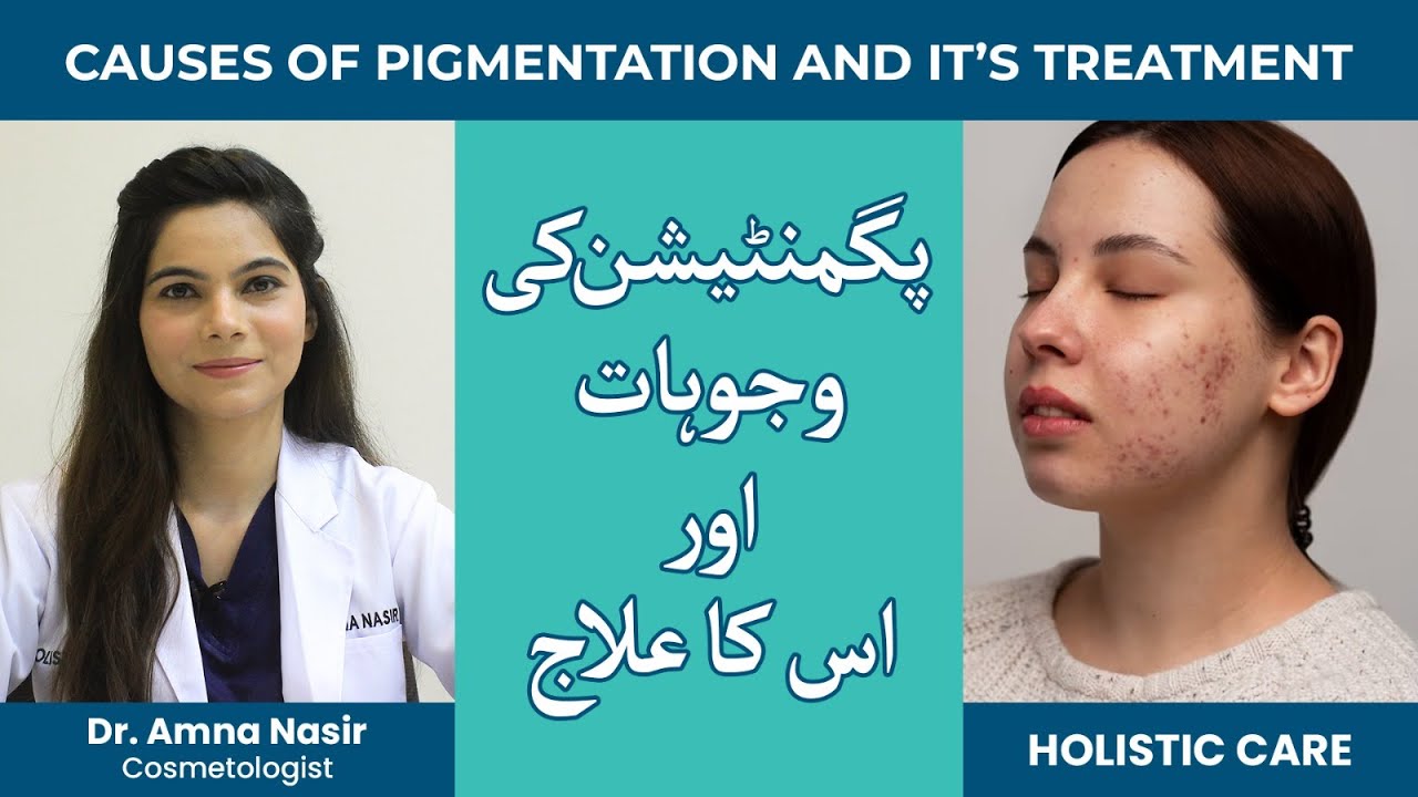 Pigmentation along with causes and solutions || Treatments || Holistic Care