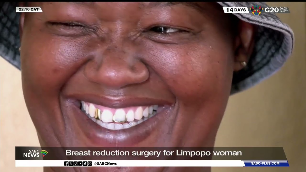 Breast reduction surgery for Limpopo woman