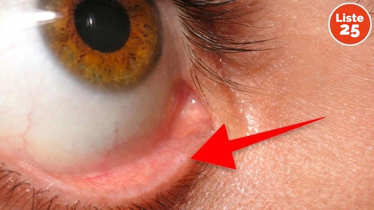 25 verrückte Fakten über den menschlichen Körper, die du noch nicht kanntest