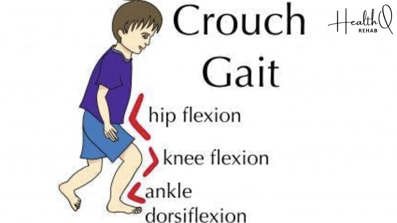 Exercises for crouched gait