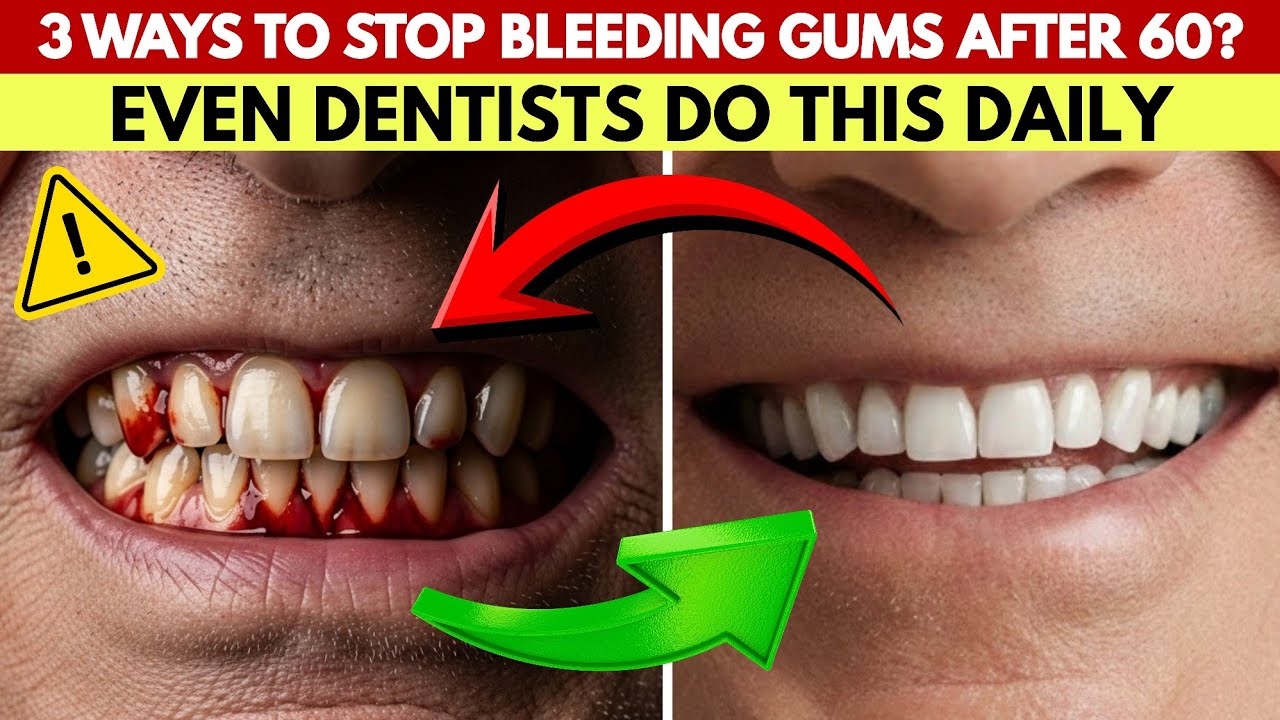 3 Dentist-Approved Ways To Stop Bleeding Gums After 60