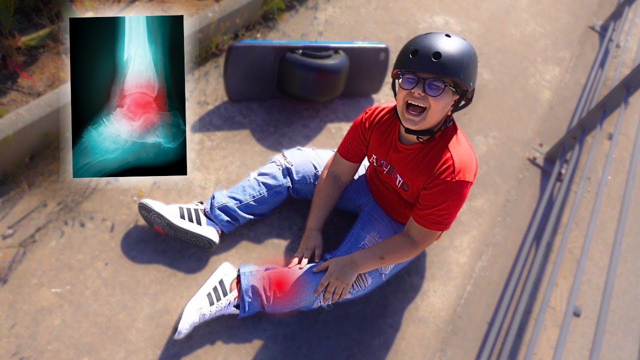 MANU CADE DALLO SKATE E SI FA MALE! *che spavento*