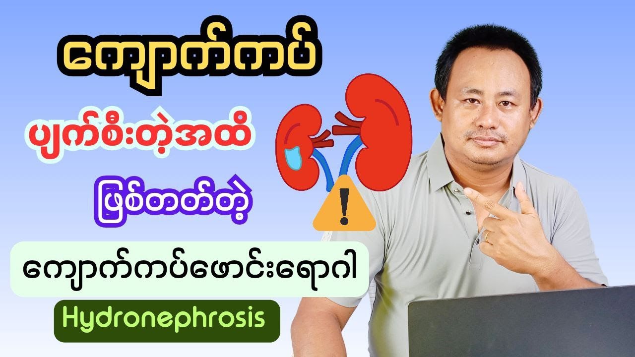 ကျောက်ကပ်ဖောင်းရောဂါ-Hydronephrosis