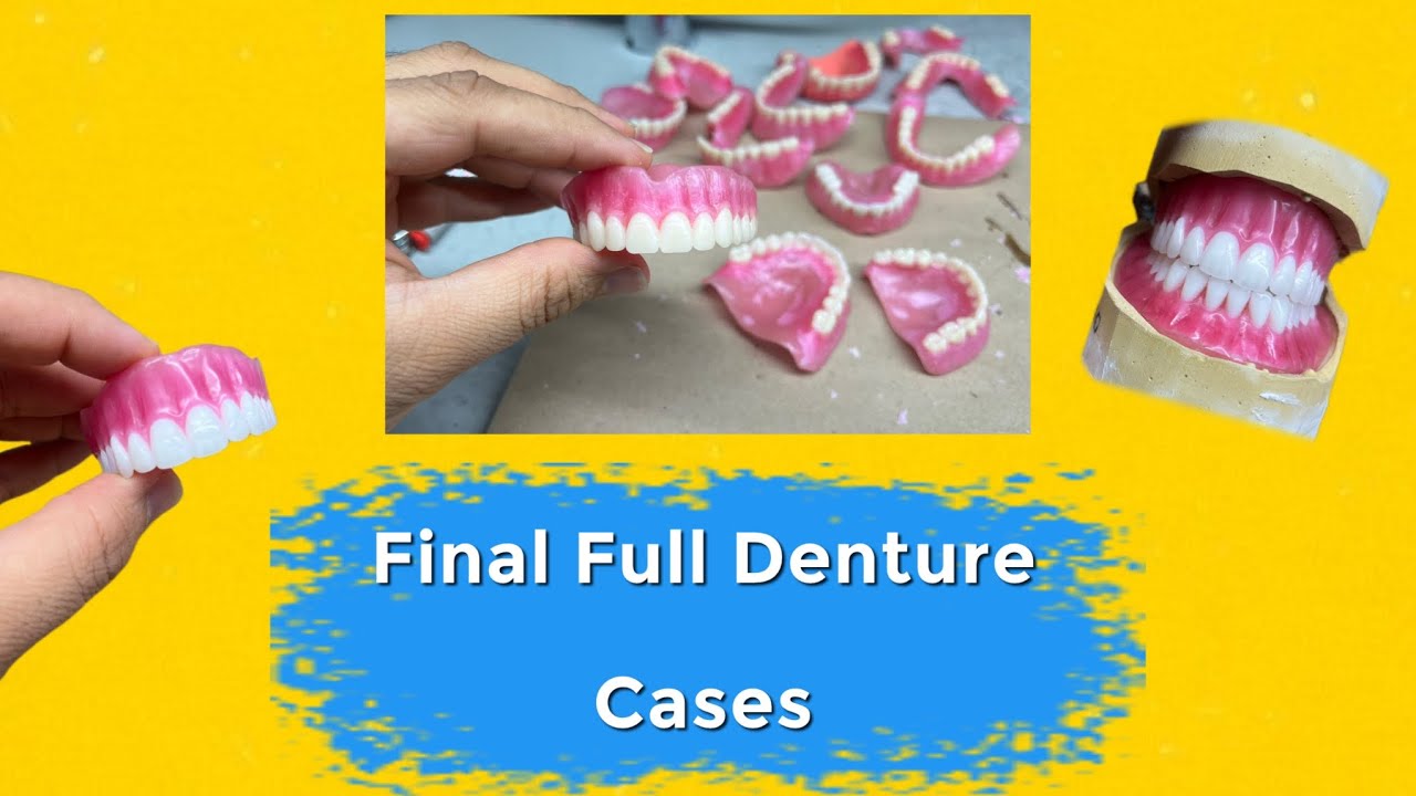 Several Full Dentures Finished in the Lab
