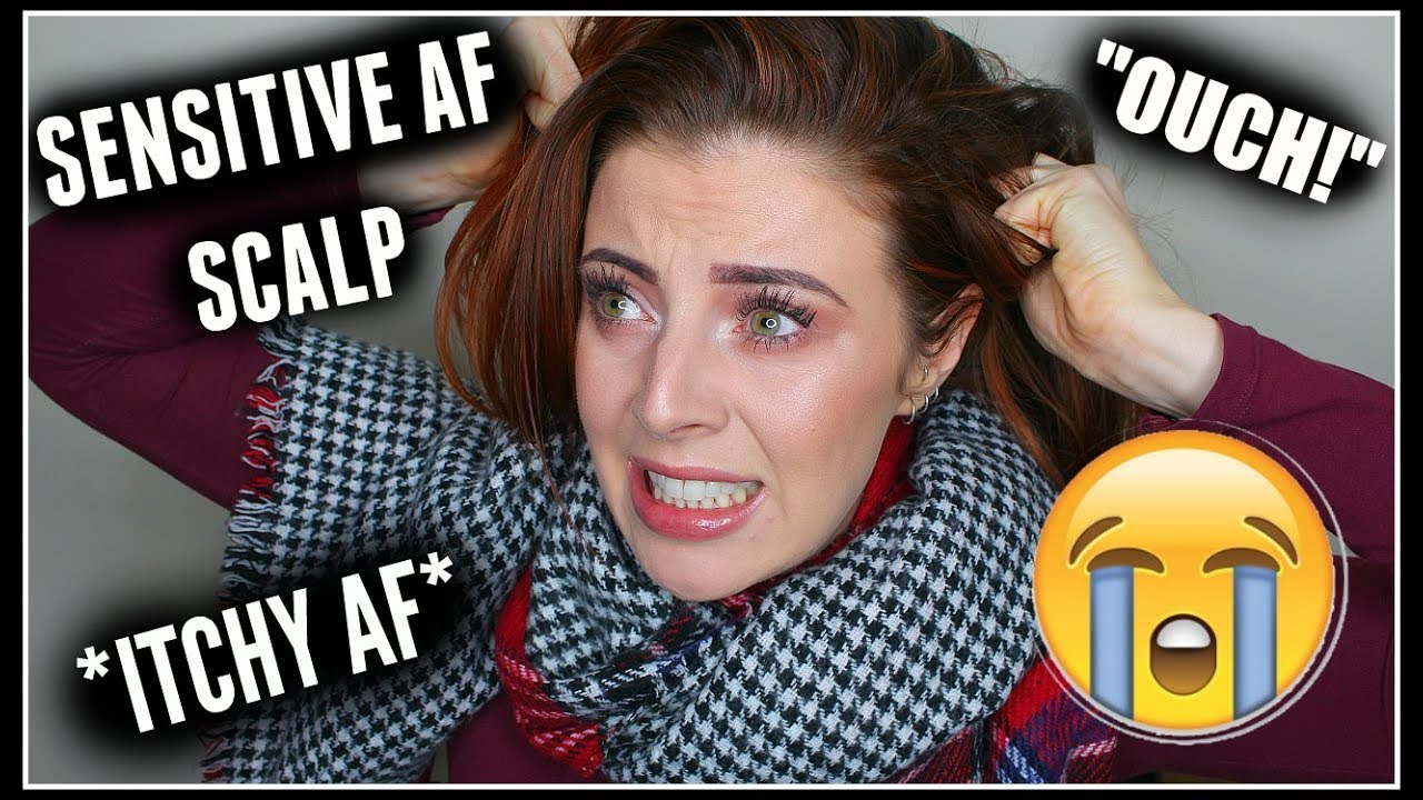 My Sensitive Scalp Solutions! [Laura's Views]