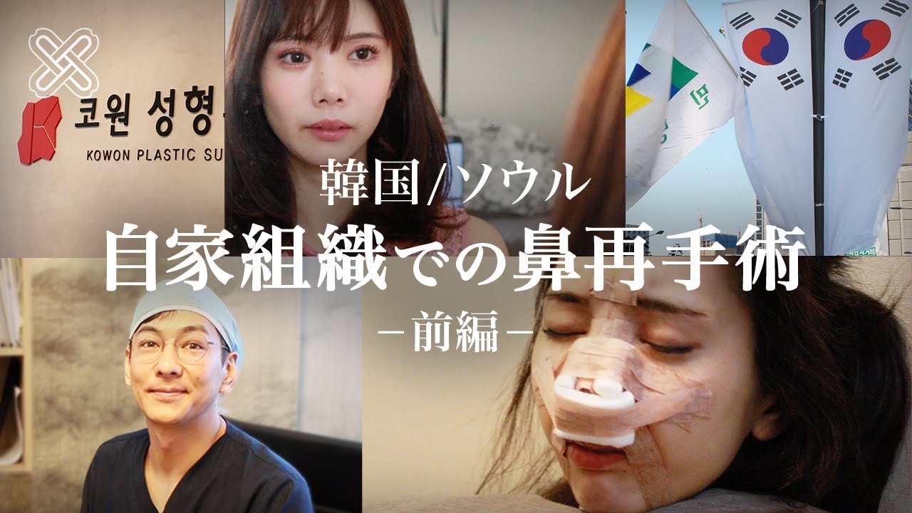 【前編】KOWON整形外科 自家組織での鼻再手術【韓国で鼻整形】