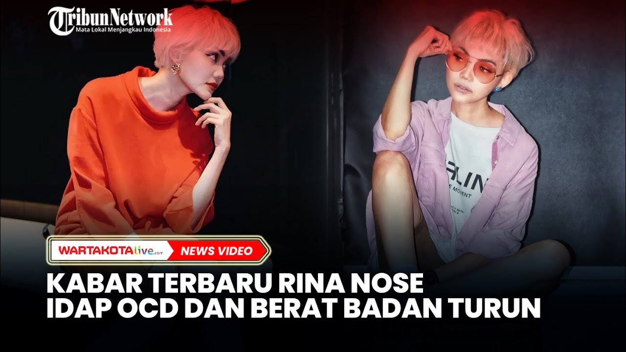 Kabar Terbaru Rina Nose, Berat Badan Turun 7 Kilogram hingga Idap OCD