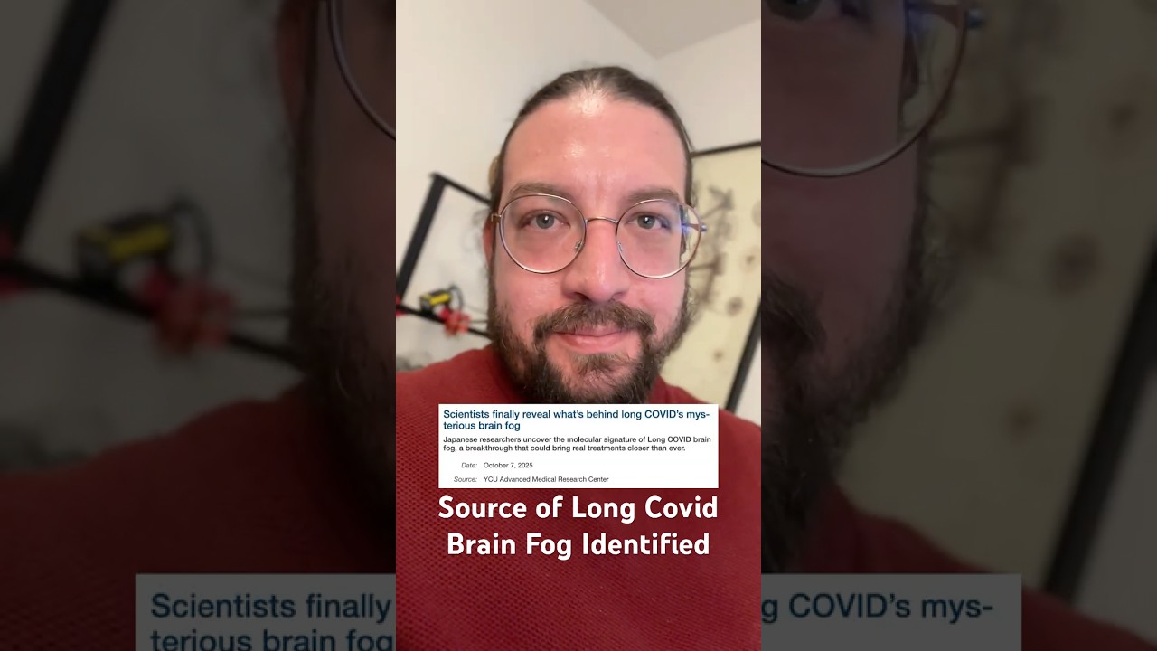Source of Long Covid Brain Fog Identified